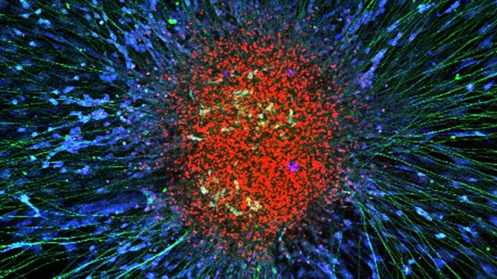 A red, purple, and yellow microscopy image with a round red center.