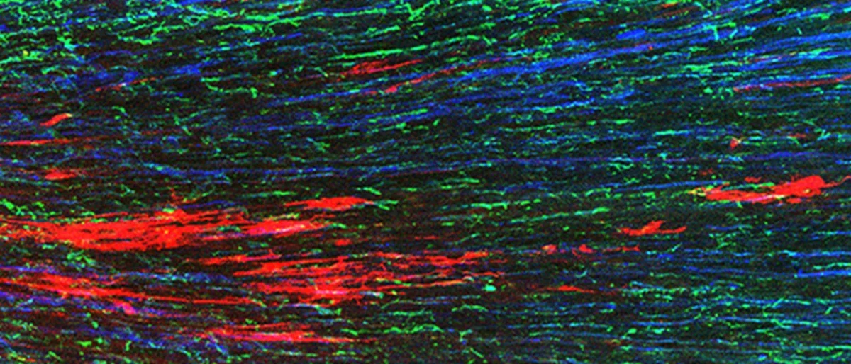 A red, green, and blue microscopy of a sciatic nerve