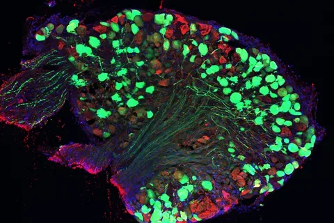 AAV_GFP-DRG-Soizic-Riche