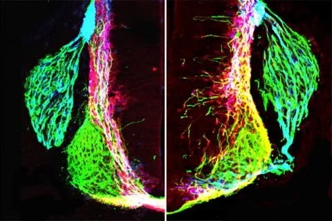 Image_netrin1-influence-on-axon-growth_0