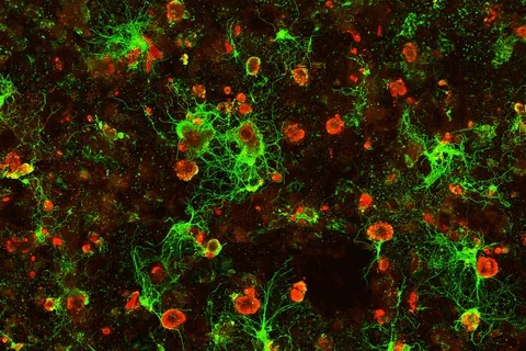 Sandeep-Gupta-sensory-neurons