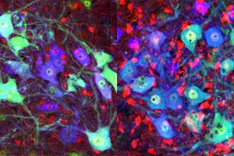 butler-neurosci-newsroom-edit