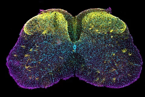 blue, purple and yellow spinal cord 