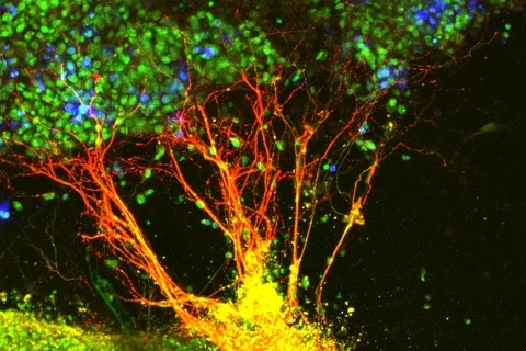 colorful image of neurons and axons that look like a tree