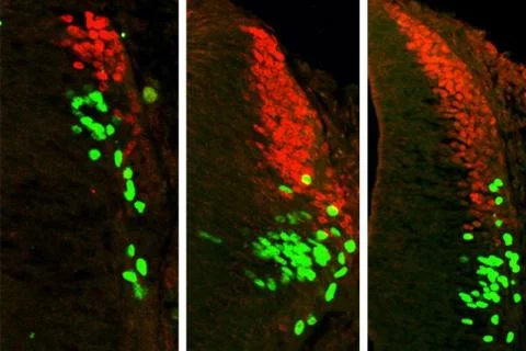 image_BMP-effect-on-sensory-interneuron-dev