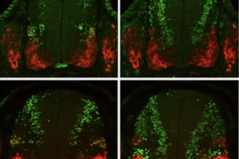 Images of sncg-expressing cells