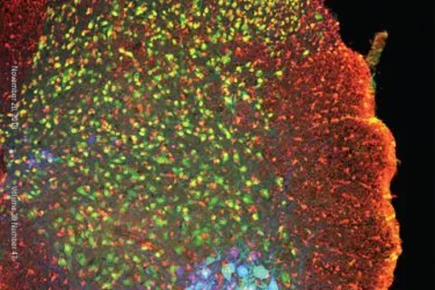 zns047190000C1_small