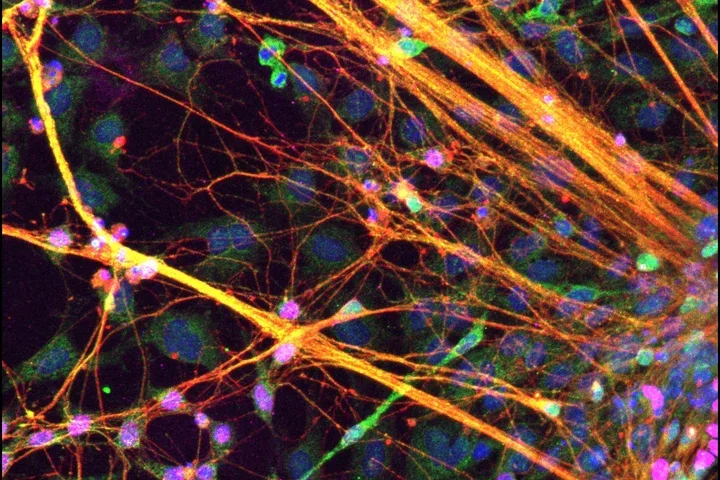 Axons projecting from stem cell derived axons