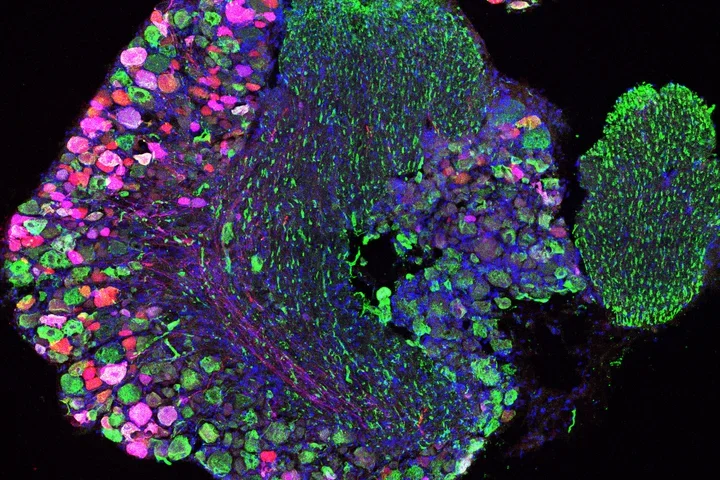 A virally infected section through a dorsal root ganglion