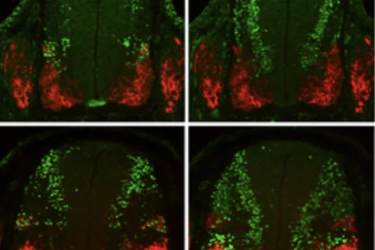 Images of sncg-expressing cells