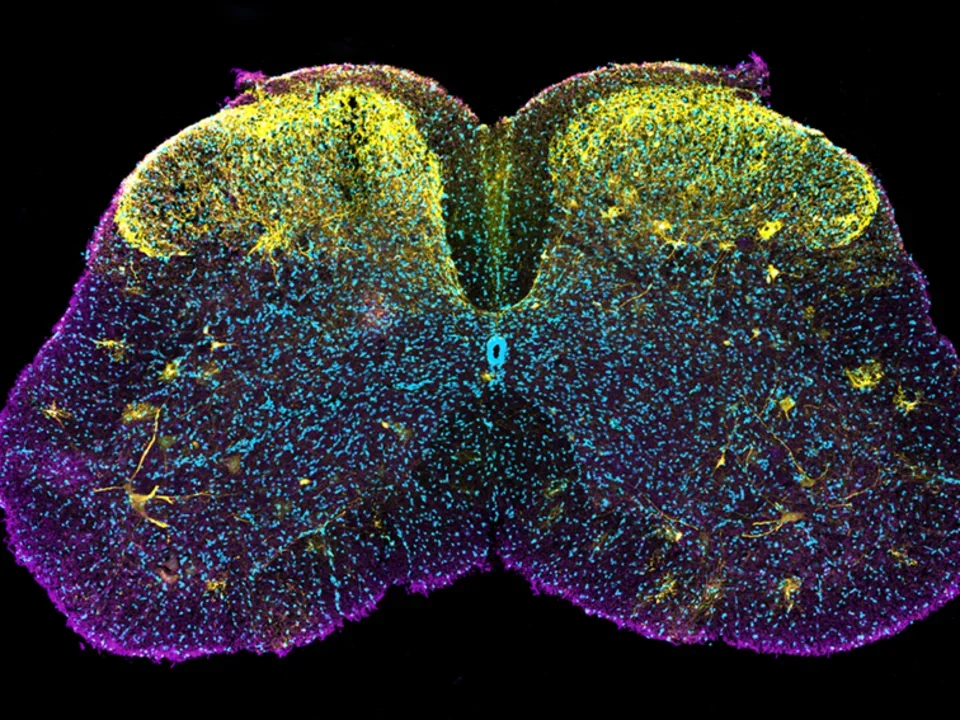 SoizicRiche_Viral-cofilin-mCherry-expression-in-the-spinal-cord_small