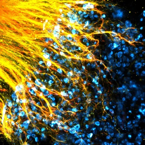 orange and yellow axons growing into a field of blue cells
