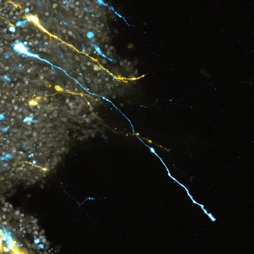 blue and yellow axons 