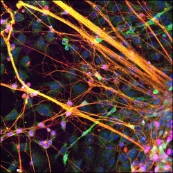 Axons projecting from stem cell derived axons