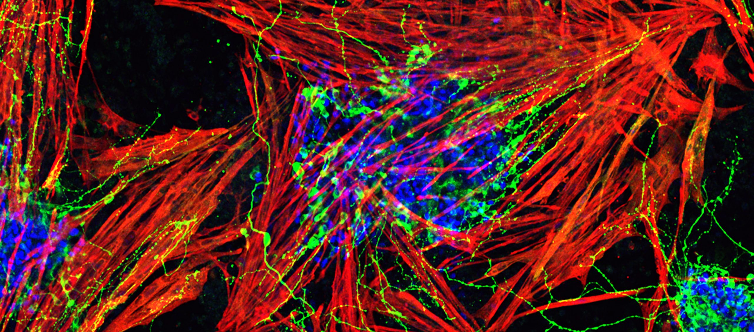 Stem cell derived muscle and motor neurons